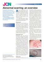 Abnormal scarring: an overview