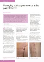 Managing postsurgical wounds in the patient’s home